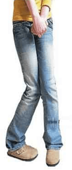 Cystitis symptoms in women